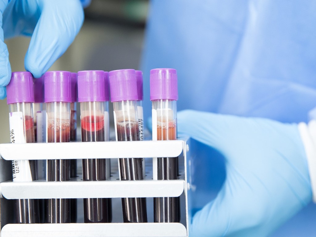 La biotech Amadix recibe un préstamo de 15 millones de euros del BEI