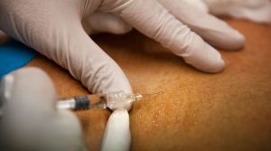 Cómo montar una clínica de medicina estética