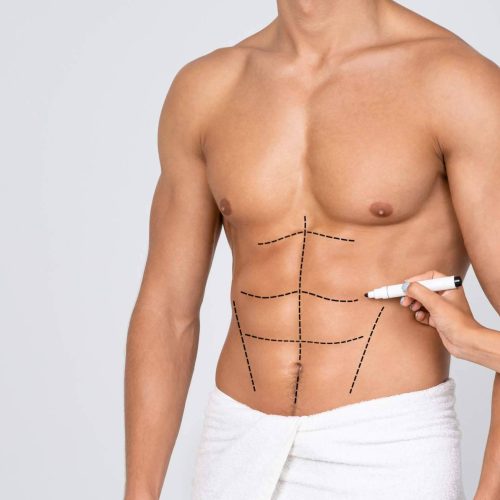 Las tres cirugías plásticas más solicitadas por hombres en 2025