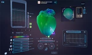La herramienta de Spika Tech permite al médico explorar el corazón como si estuviese dentro